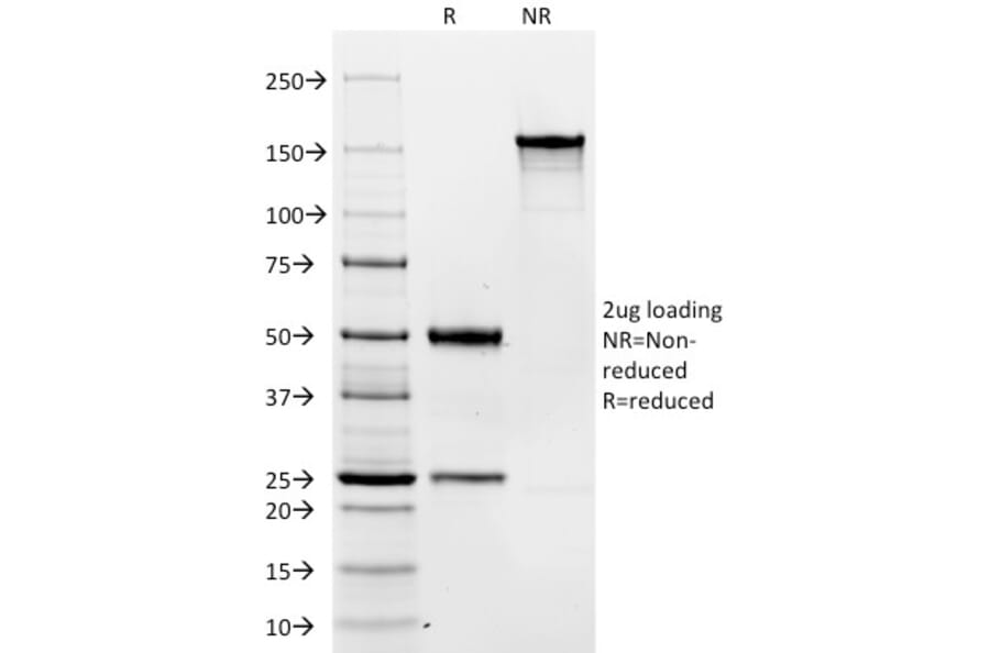 SDS-PAGE - Anti-CD19 Antibody [C19/366] (A250584) - Antibodies.com