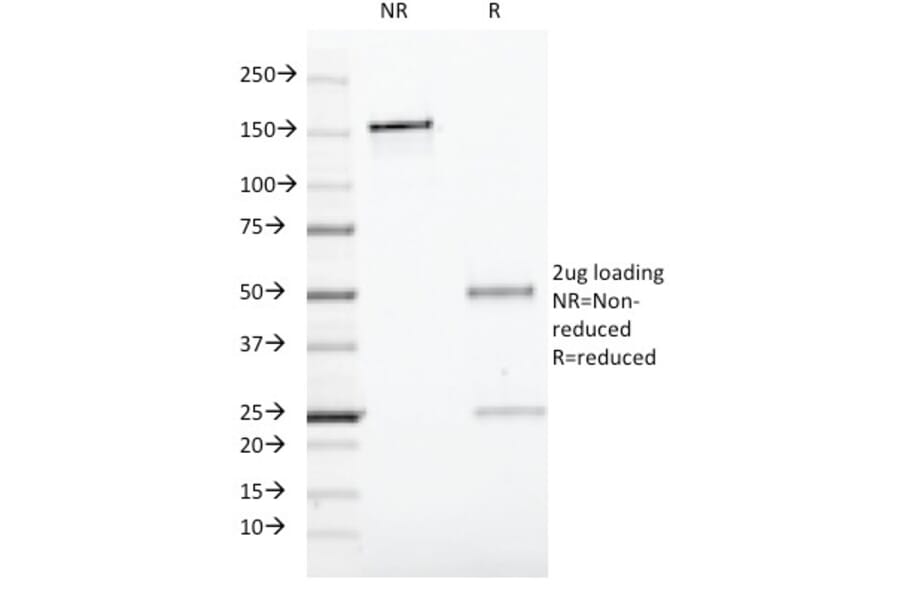 SDS-PAGE - Anti-CD19 Antibody [CVID3/429] (A250587) - Antibodies.com