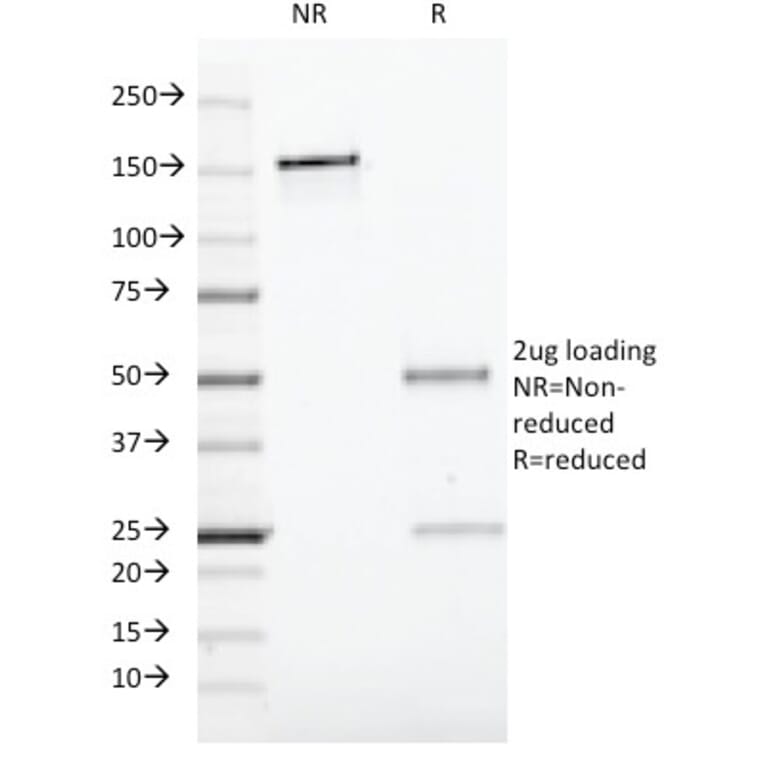 SDS-PAGE - Anti-CD19 Antibody [CVID3/429] (A250587) - Antibodies.com