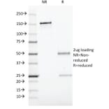 SDS-PAGE - Anti-CD19 Antibody [CVID3/429] (A250587) - Antibodies.com