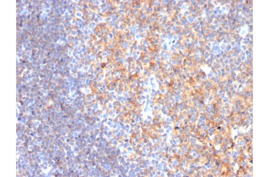 Immunohistochemistry - Anti-CD19 Antibody [CD19/3116] (A250588) - Antibodies.com