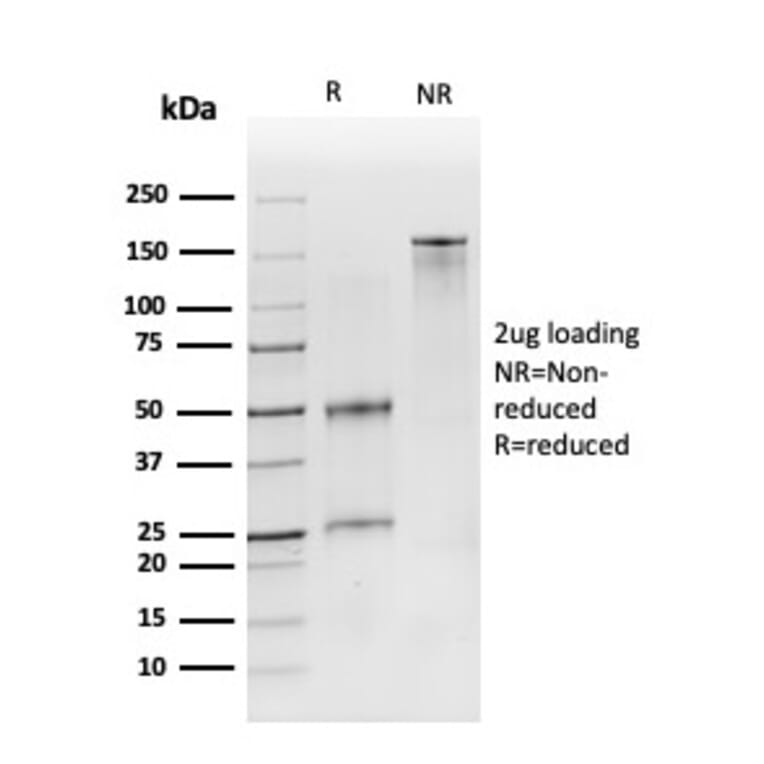 SDS-PAGE - Anti-CD19 Antibody [CD19/3116] (A250588) - Antibodies.com