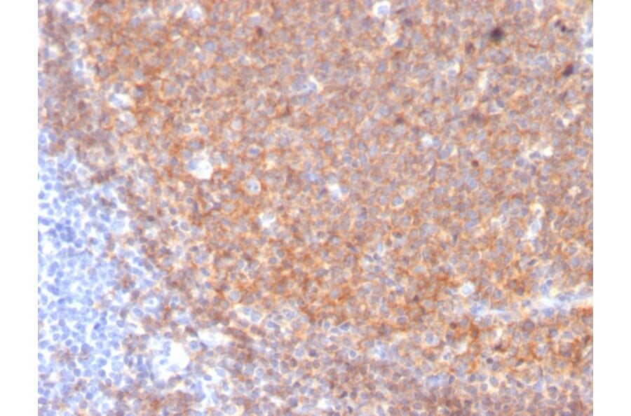 Immunohistochemistry - Anti-CD19 Antibody [CD19/3117] (A250589) - Antibodies.com