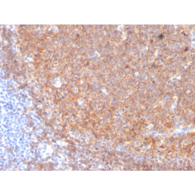 Immunohistochemistry - Anti-CD19 Antibody [CD19/3117] (A250589) - Antibodies.com