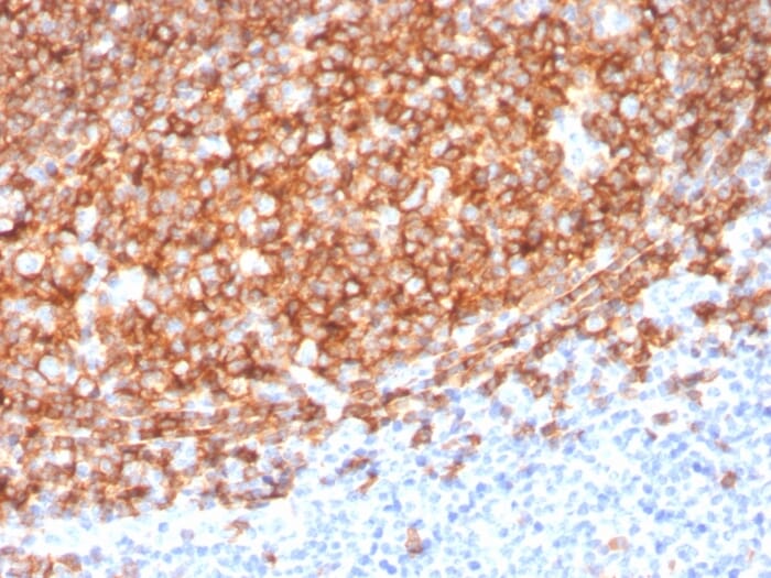 Immunohistochemical analysis of formalin-fixed, paraffin-embedded human tonsil using Anti-CD20 Antibody [MS4A1/3410].