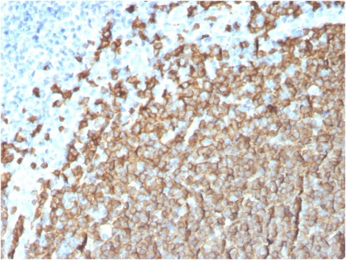 Immunohistochemical analysis of formalin-fixed, paraffin-embedded human tonsil using Anti-CD20 Antibody [MS4A1/3411].