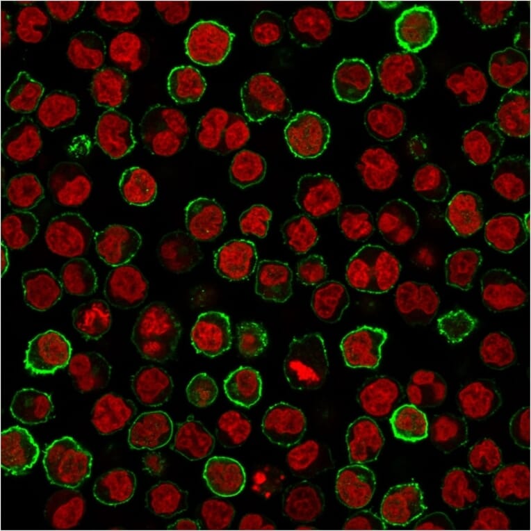 Immunofluorescence - Anti-CD20 Antibody [MS4A1/3411] (A250591) - Antibodies.com