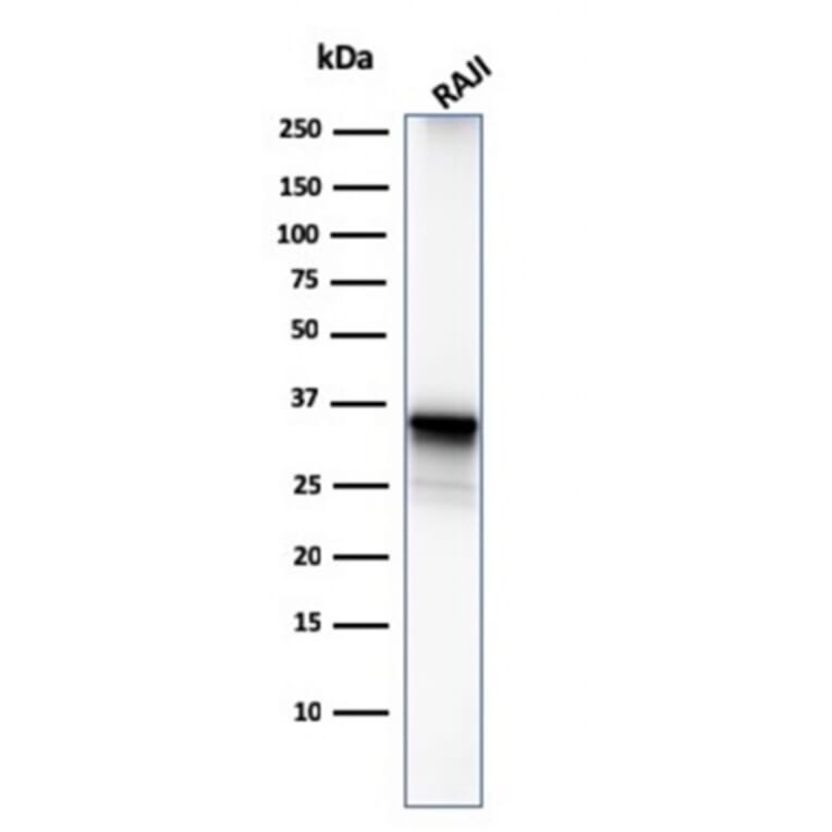 Western Blot - Anti-CD20 Antibody [MS4A1/3411] (A250591) - Antibodies.com