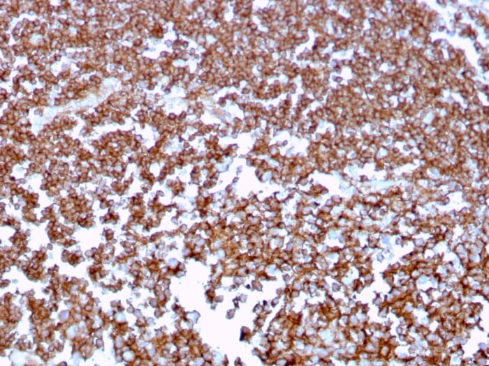 Immunohistochemical analysis of formalin-fixed, paraffin-embedded human tonsil using Anti-CD20 Antibody [MS4A1/3409].