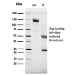 SDS-PAGE - Anti-CD20 Antibody [MS4A1/3409] (A250592) - Antibodies.com