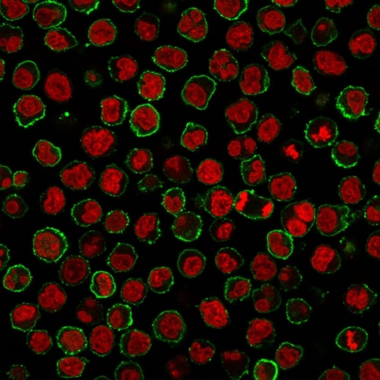 Immunofluorescence - Anti-CD20 Antibody [MS4A1/3409] (A250592) - Antibodies.com