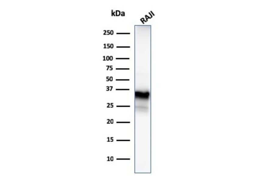 Western Blot - Anti-CD20 Antibody [MS4A1/3409] (A250592) - Antibodies.com