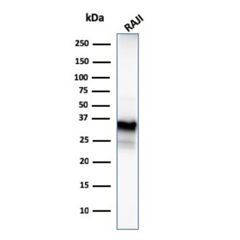Western Blot - Anti-CD20 Antibody [MS4A1/3409] (A250592) - Antibodies.com