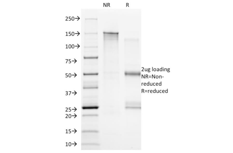 SDS-PAGE - Anti-CD20 Antibody [B9E9] (A250592) - Antibodies.com