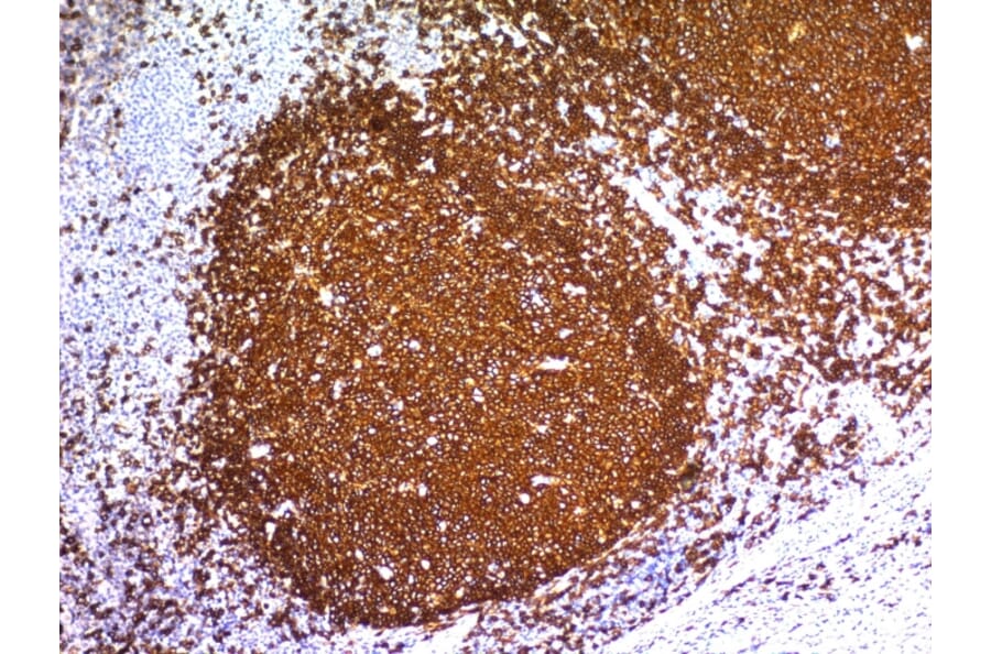 Immunohistochemistry - Anti-CD20 Antibody [L26] (A250594) - Antibodies.com