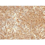 Immunohistochemistry - Anti-CD20 Antibody [L26] (A250594) - Antibodies.com