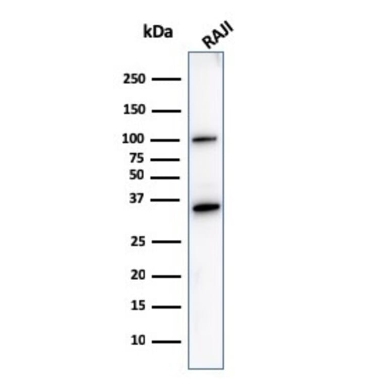 Western Blot - Anti-CD20 Antibody [L26] (A250594) - Antibodies.com