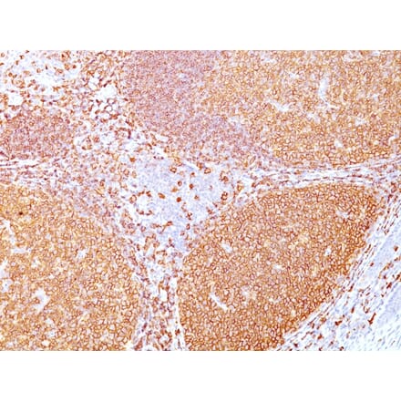 Immunohistochemistry - Anti-CD20 Antibody [IGEL/773] (A250595) - Antibodies.com