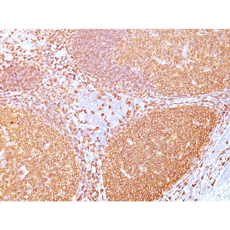 Immunohistochemistry - Anti-CD20 Antibody [IGEL/773] (A250595) - Antibodies.com