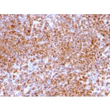 Immunohistochemistry - Anti-CD20 Antibody [IGEL/773] (A250595) - Antibodies.com