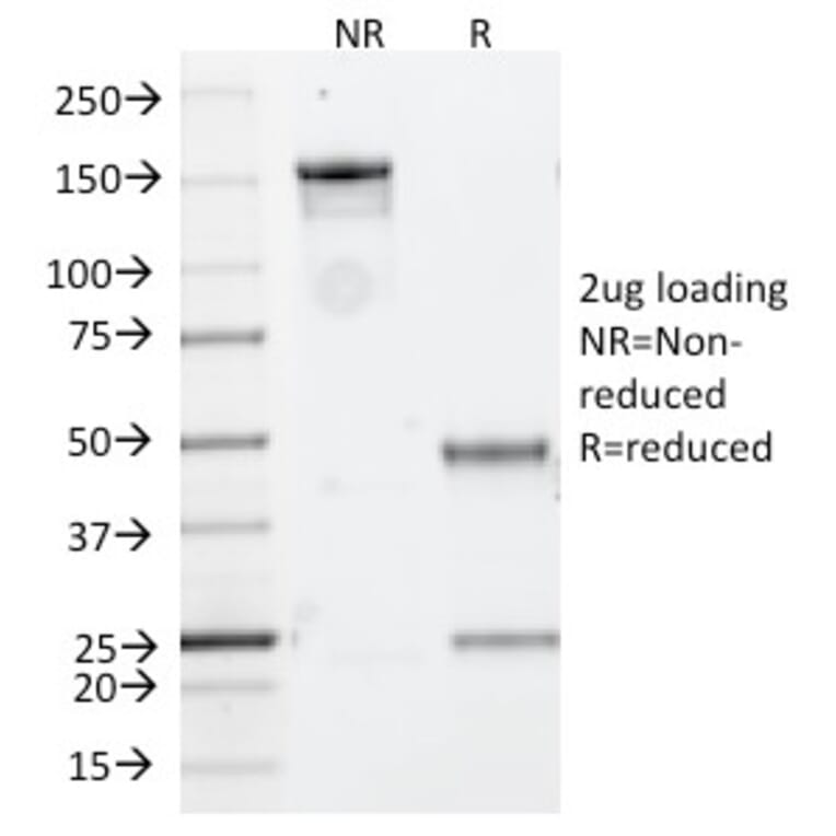 SDS-PAGE - Anti-CD20 Antibody [IGEL/773] (A250595) - Antibodies.com