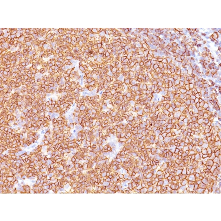 Immunohistochemistry - Anti-CD20 Antibody [SPM618] (A250596) - Antibodies.com