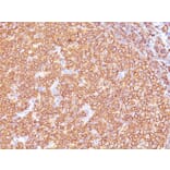 Immunohistochemistry - Anti-CD20 Antibody [SPM618] (A250596) - Antibodies.com