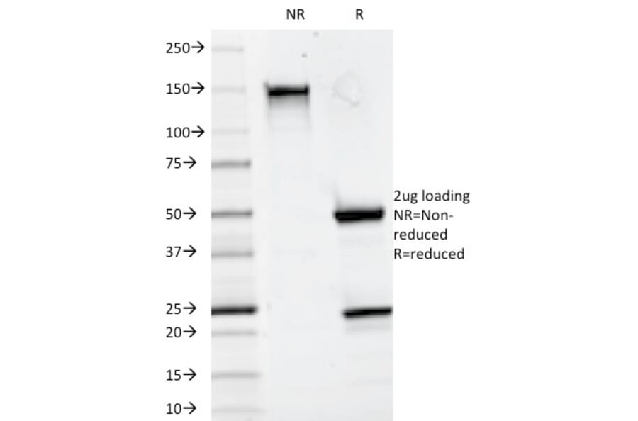 SDS-PAGE - Anti-CD20 Antibody [93-1B3] (A250596) - Antibodies.com