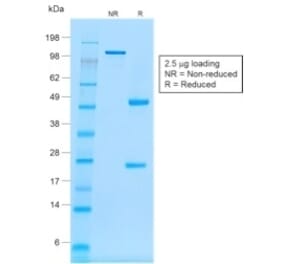 SDS-PAGE - Anti-CD20 Antibody [rIGEL/773] (A250599) - Antibodies.com