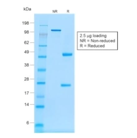SDS-PAGE - Anti-CD20 Antibody [rIGEL/773] (A250599) - Antibodies.com