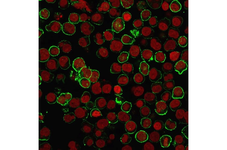 Immunofluorescence - Anti-CD20 Antibody [rIGEL/773] (A250599) - Antibodies.com