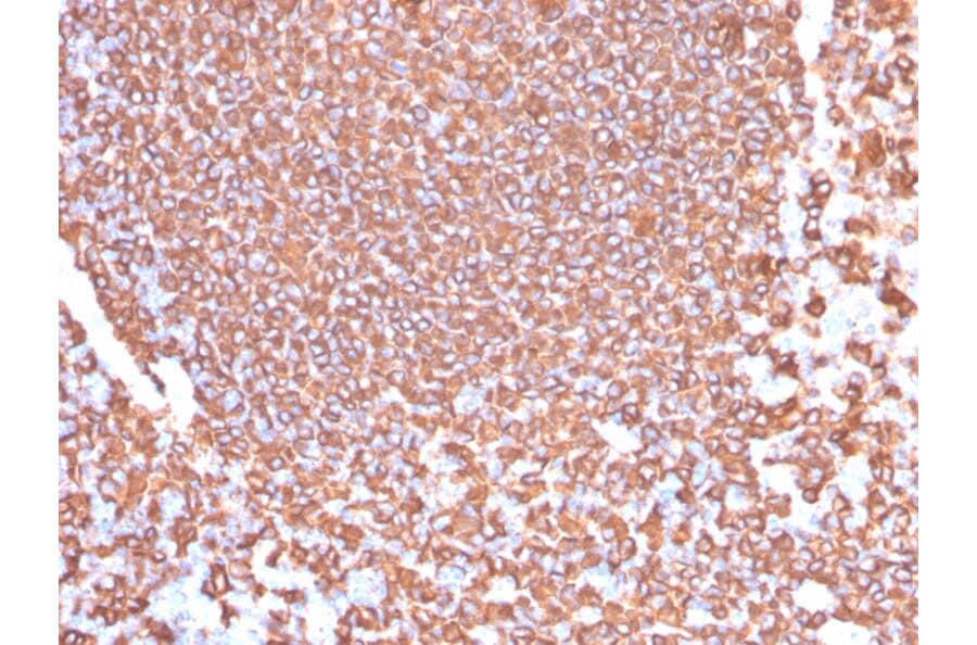 Immunohistochemistry - Anti-CD20 Antibody [IGEL/4524R] (A253781) - Antibodies.com