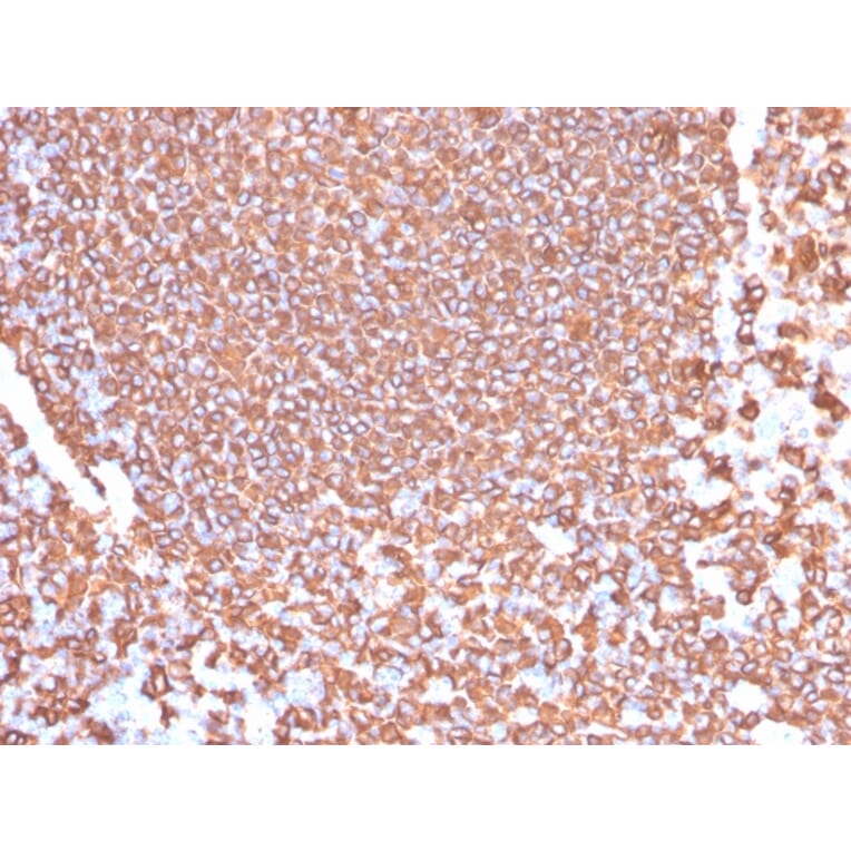 Immunohistochemistry - Anti-CD20 Antibody [IGEL/4524R] (A253781) - Antibodies.com