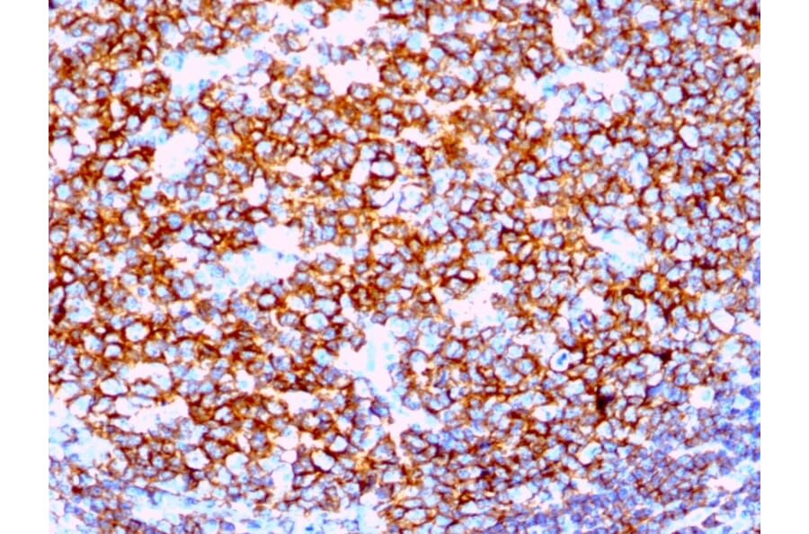 Immunohistochemistry - Anti-CD20 Antibody [IGEL/1497R] (A250601) - Antibodies.com