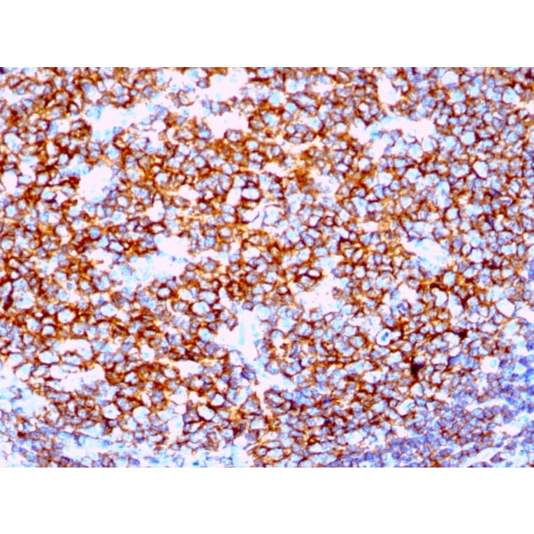 Immunohistochemistry - Anti-CD20 Antibody [IGEL/1497R] (A250601) - Antibodies.com
