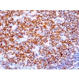 Immunohistochemistry - Anti-CD20 Antibody [IGEL/1497R] (A250601) - Antibodies.com
