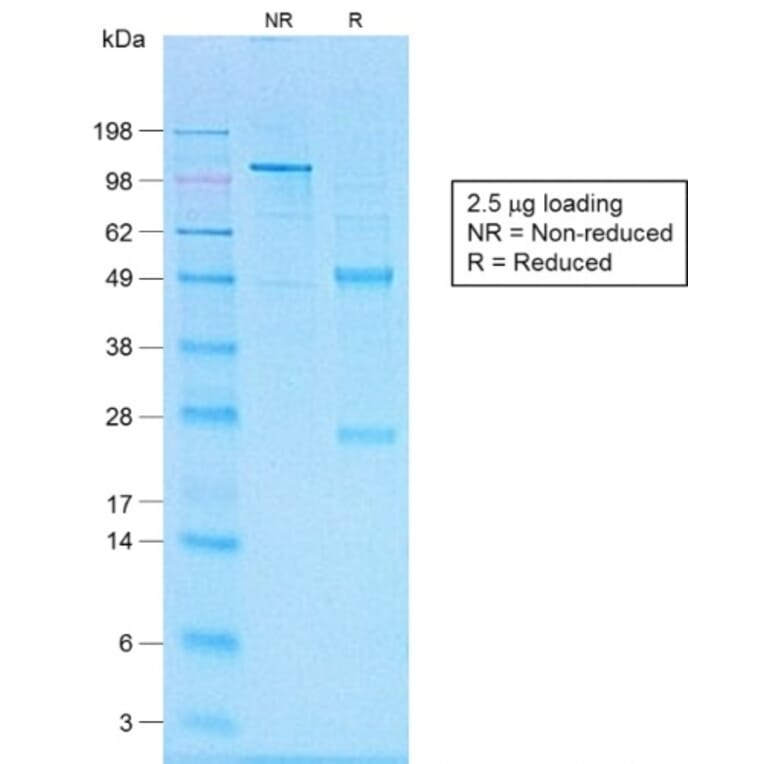 SDS-PAGE - Anti-CD20 Antibody [IGEL/1497R] (A250601) - Antibodies.com