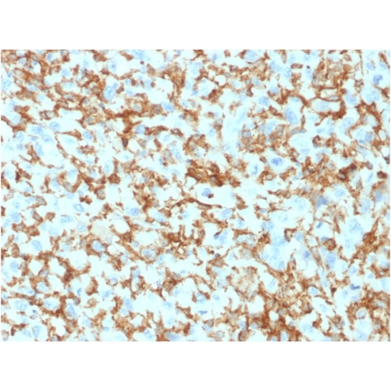 Immunohistochemistry - Anti-CD163 Antibody [M130/1210] (A250603) - Antibodies.com