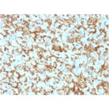 Immunohistochemistry - Anti-CD163 Antibody [M130/1210] (A250603) - Antibodies.com