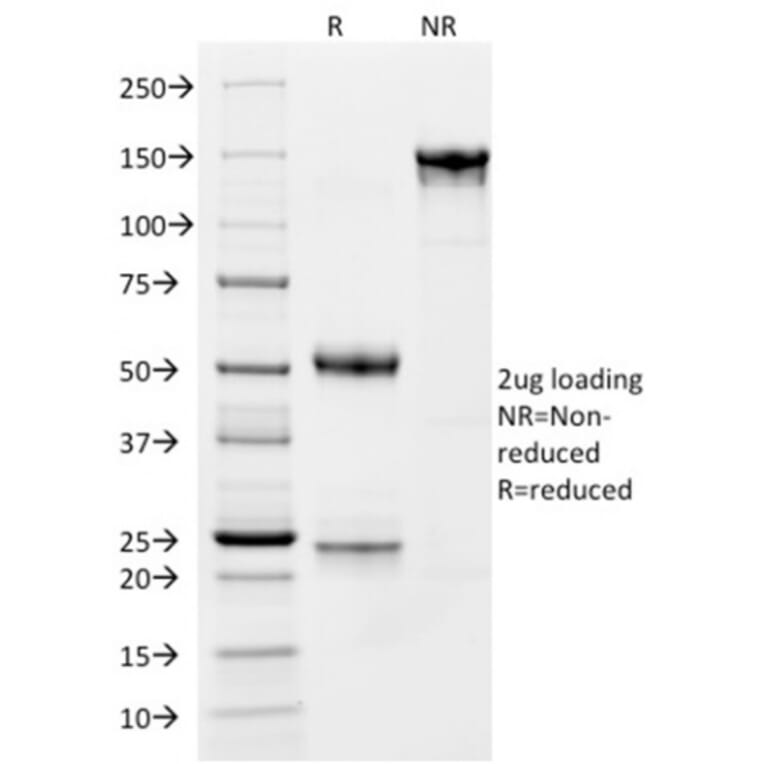 SDS-PAGE - Anti-CD163 Antibody [M130/1210] (A250603) - Antibodies.com