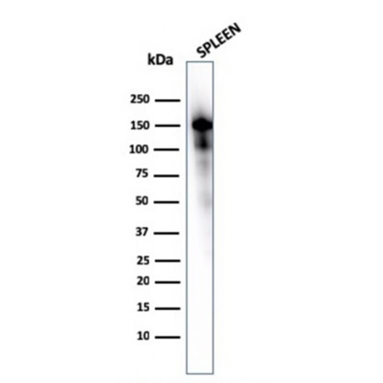 Western Blot - Anti-CD163 Antibody [M130/1210] (A250603) - Antibodies.com
