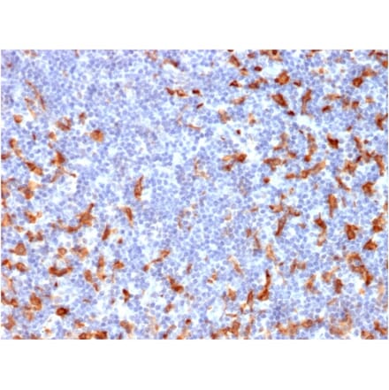 Immunohistochemistry - Anti-CD163 Antibody [M130/2162] (A250604) - Antibodies.com