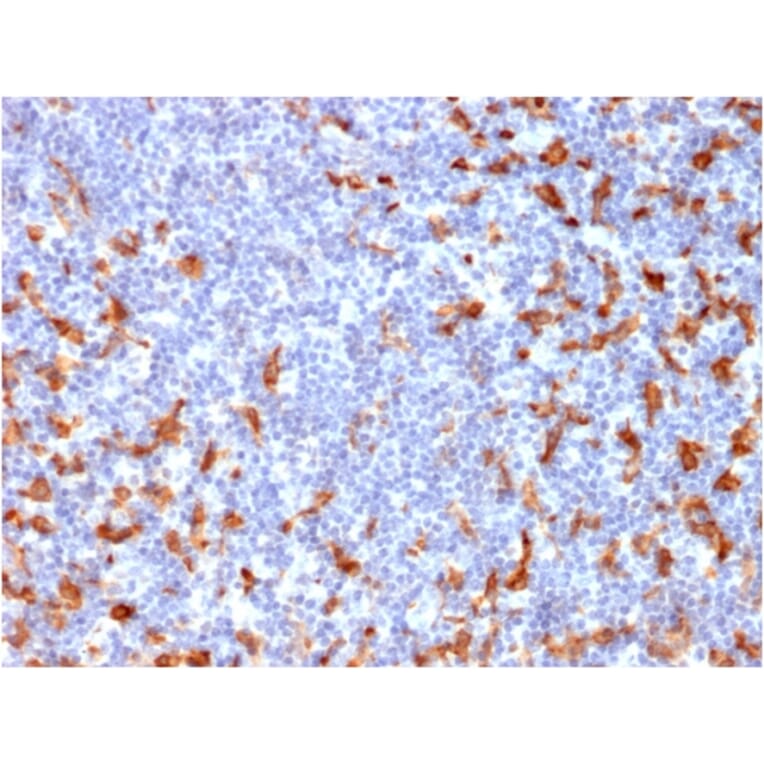 Immunohistochemistry - Anti-CD163 Antibody [M130/2162] (A250604) - Antibodies.com