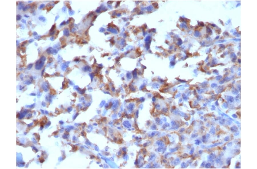Immunohistochemistry - Anti-CD163 Antibody [M130/2162] (A250604) - Antibodies.com