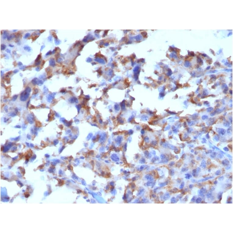 Immunohistochemistry - Anti-CD163 Antibody [M130/2162] (A250604) - Antibodies.com