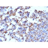 Immunohistochemistry - Anti-CD163 Antibody [M130/2162] (A250604) - Antibodies.com