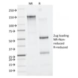 SDS-PAGE - Anti-CD163 Antibody [M130/2162] (A250604) - Antibodies.com