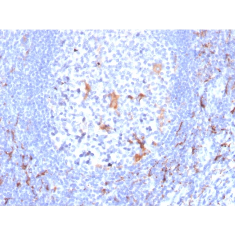 Immunohistochemistry - Anti-CD163 Antibody [M130/2163] (A250605) - Antibodies.com