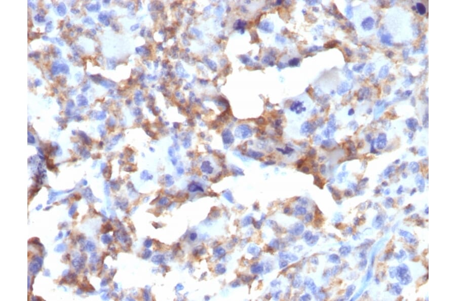 Immunohistochemistry - Anti-CD163 Antibody [M130/2163] (A250604) - Antibodies.com