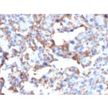 Immunohistochemistry - Anti-CD163 Antibody [M130/2163] (A250604) - Antibodies.com